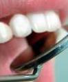 Teeth Whitening - Online Information Resource